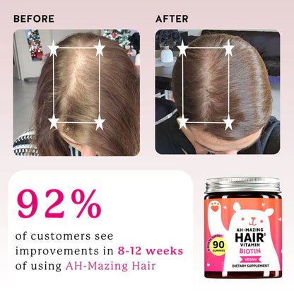 Biotin Hair Gummies: Reduce Hair Loss & Support Stronger, Healthier Growth