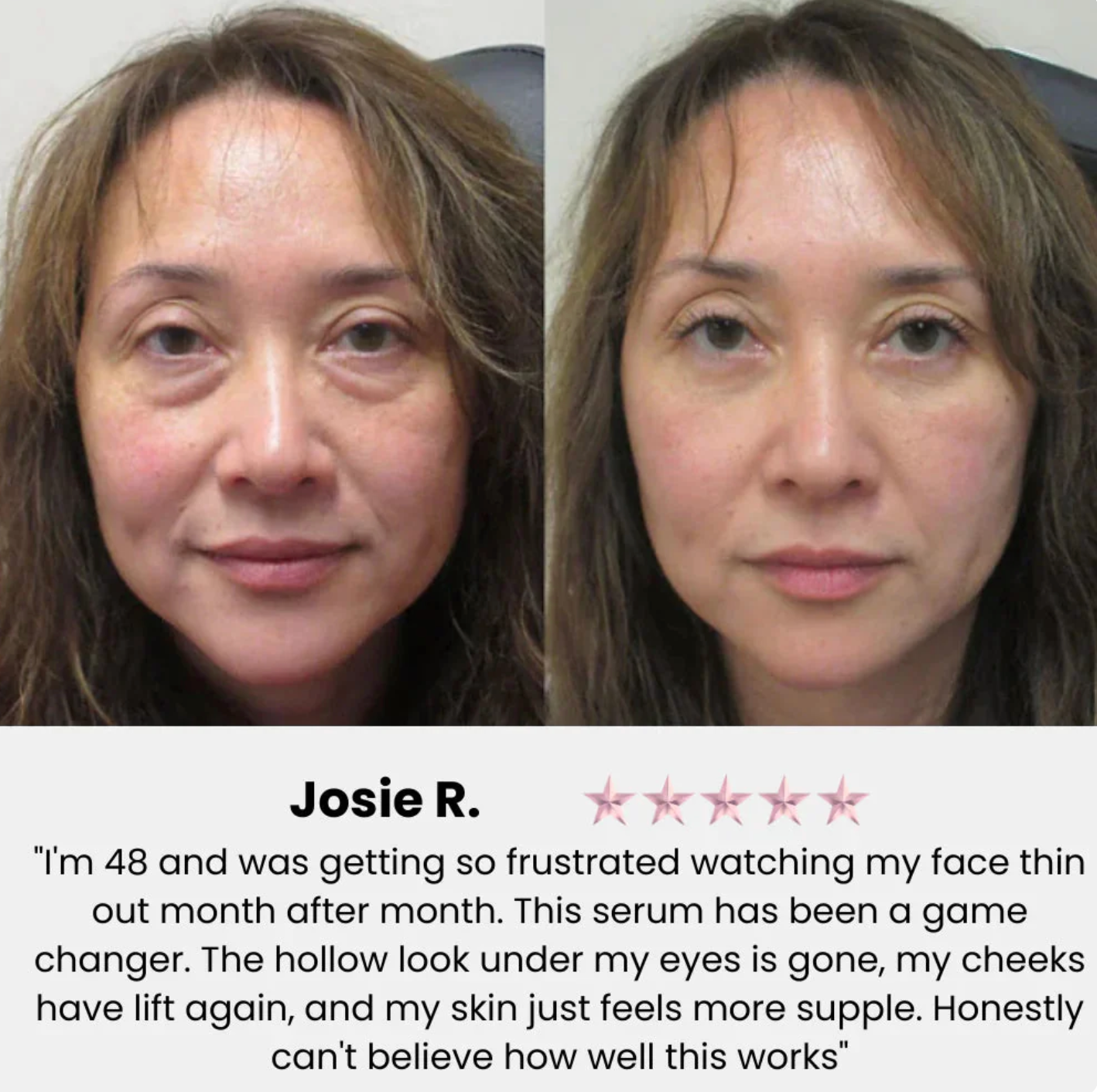 Emerse Collagen Filler Serum